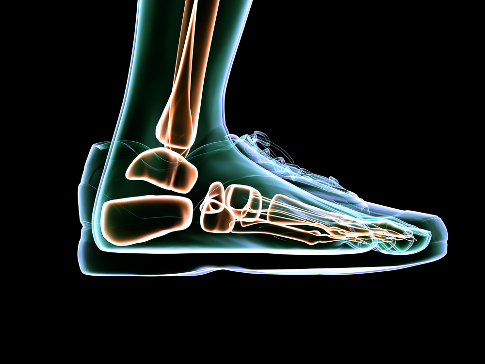 AFT-opbouw-en-afwerking-orthopedische-schoenen